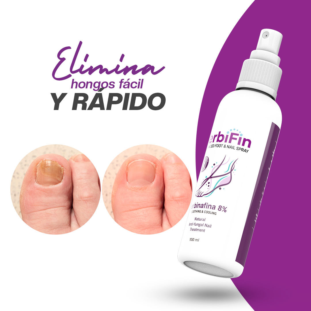 TERBIFIN PARA HONGOS EN MANOS Y PIES M.P